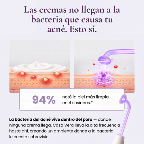 La Varita Casa Vera